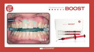 opalescence boost packaging