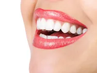 Woman Smiling with Clear Braces on